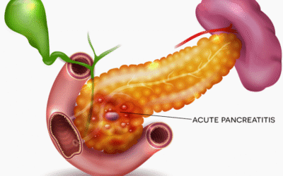 Ayurveda and Pancreatitis: An Expert Overview